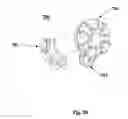 Fig. 17 - Devices and methods for dilating a paranasal sinus opening and for treating sinusitis