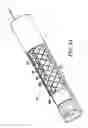 Fig. 11 - Push/pull wire anchor