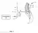 Fig. 02 - FLUID DELIVERY DEVICE WITH ACTIVE AND PASSIVE FLUID DELIVERY