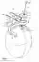 Fig. 02 - Surgical Apparatus