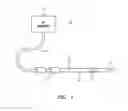 Fig. 02 - Low-profile, expanding single needle ablation probe