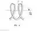 Fig. 04 - Low-profile, expanding single needle ablation probe