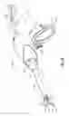 Fig. 03 - Bipolar chondroplasty device