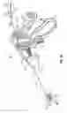 Fig. 04 - Bipolar chondroplasty device