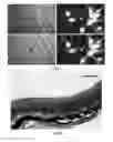 Fig. 07 - METHOD AND SYSTEM FOR NERVE REPAIR, NANOKNIFE, MEMS PLATFORM AND USES THEREOF