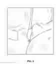 Fig. 05 - Method for plasma-mediated thermo-electrical ablation with low temperature electrode