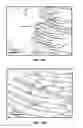Fig. 14 - Method for plasma-mediated thermo-electrical ablation with low temperature electrode