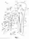 Fig. 02 - Method and apparatus for osteosynthesis