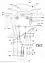 Fig. 05 - Method and apparatus for osteosynthesis