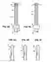 Fig. 04 - Combination male/female hip joint and installation kit