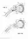 Fig. 09 - Combination male/female hip joint and installation kit