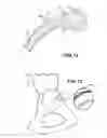 Fig. 10 - Combination male/female hip joint and installation kit