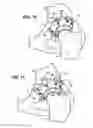 Fig. 12 - Combination male/female hip joint and installation kit