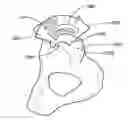 Fig. 01 - Implants, surgical methods, and instrumentation for use in femoroacetabular impingement surgeries