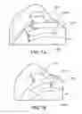 Fig. 07 - Implants, surgical methods, and instrumentation for use in femoroacetabular impingement surgeries