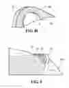 Fig. 09 - Implants, surgical methods, and instrumentation for use in femoroacetabular impingement surgeries