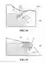 Fig. 10 - Implants, surgical methods, and instrumentation for use in femoroacetabular impingement surgeries
