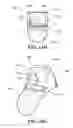 Fig. 13 - Implants, surgical methods, and instrumentation for use in femoroacetabular impingement surgeries