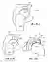 Fig. 14 - Implants, surgical methods, and instrumentation for use in femoroacetabular impingement surgeries