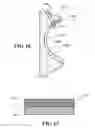 Fig. 15 - Implants, surgical methods, and instrumentation for use in femoroacetabular impingement surgeries