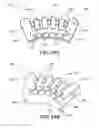 Fig. 16 - Implants, surgical methods, and instrumentation for use in femoroacetabular impingement surgeries