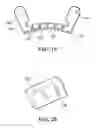 Fig. 17 - Implants, surgical methods, and instrumentation for use in femoroacetabular impingement surgeries