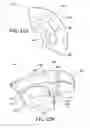 Fig. 19 - Implants, surgical methods, and instrumentation for use in femoroacetabular impingement surgeries