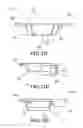 Fig. 20 - Implants, surgical methods, and instrumentation for use in femoroacetabular impingement surgeries