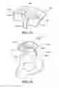 Fig. 22 - Implants, surgical methods, and instrumentation for use in femoroacetabular impingement surgeries