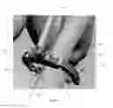 Fig. 07 - Tool and method for digital acquisition of a tibial mechanical axis