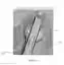 Fig. 08 - Tool and method for digital acquisition of a tibial mechanical axis