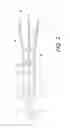 Fig. 03 - Endoscopic Instrument with Rotational and Axial Motion Control