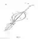 Fig. 07 - Medical snare device