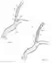 Fig. 10 - Medical snare device