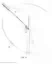 Fig. 19 - Medical snare device