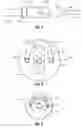 Fig. 05 - Suturing devices and methods