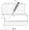 Fig. 06 - Suturing devices and methods