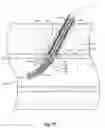Fig. 09 - Suturing devices and methods