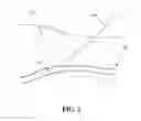 Fig. 02 - METHODS FOR FORMING TRACTS IN TISSUE