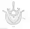 Fig. 35 - Apparatus and methods for bone, tissue and duct dilatation