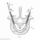 Fig. 40 - Apparatus and methods for bone, tissue and duct dilatation