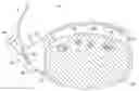 Fig. 01 - Vascular compression apparatus, pad and method of use