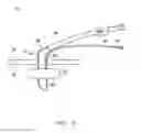 Fig. 03 - Wound sealing fluid delivery apparatus and method