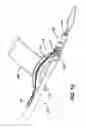 Fig. 09 - Knotless suture anchor and driver