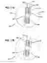 Fig. 16 - Knotless suture anchor and driver