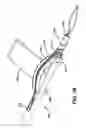 Fig. 09 - Knotless suture anchor