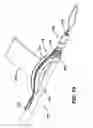 Fig. 09 - SUTURE ANCHOR AND THREADER