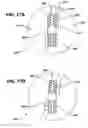 Fig. 16 - Anchor driver with suture clutch