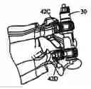 Fig. 01 - System and method for replacement of spinal motion segment
