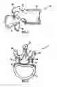 Fig. 02 - System and method for replacement of spinal motion segment